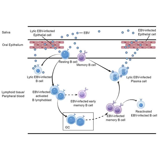 EB Virus : Understanding and Managing The Hidden Villain